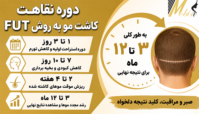 دوره نقاهت کاشت مو به روش FUT چقدر است؟