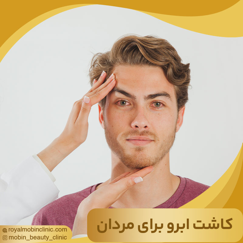 کاشت ابرو برای مردان