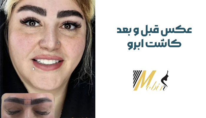 عکس قبل و بعد کاش ابرو