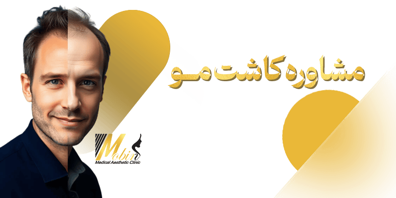 مشاوره کاشت مو