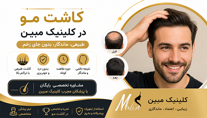 کاشت مو در کلینیک مبین