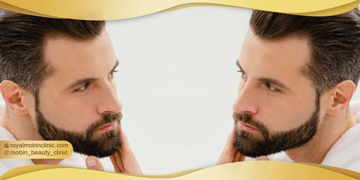 عوارض کاشت ریش و سبیل