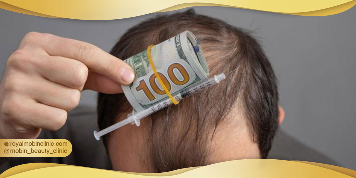 هزینه کاشت مو در ایران چقدر است؟
