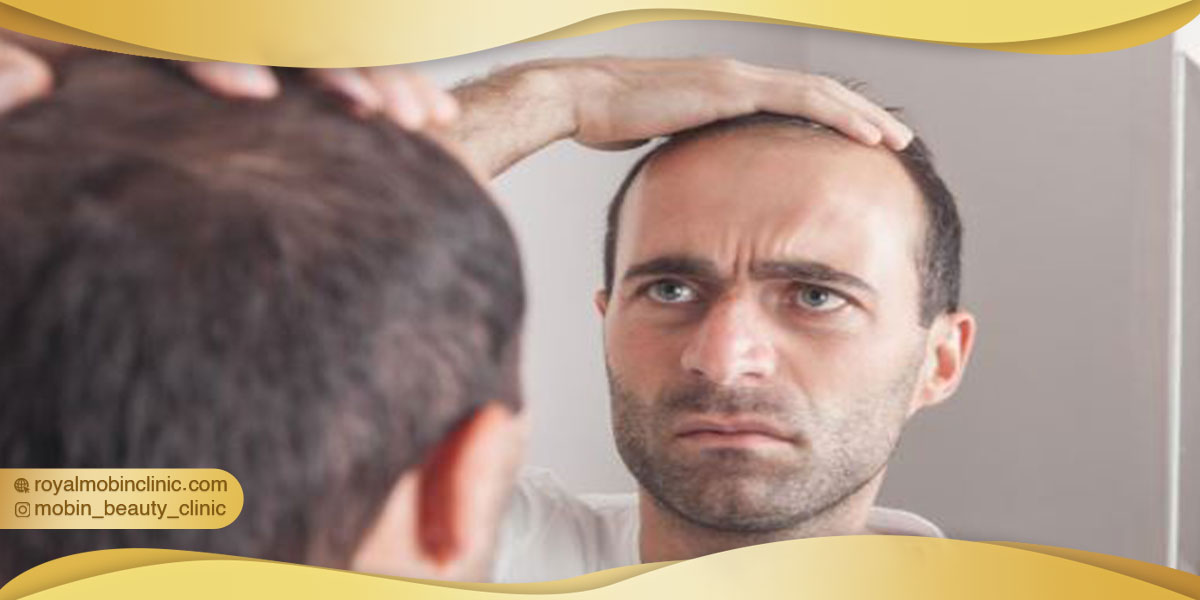 توصیه بیماران برای کاشت مو