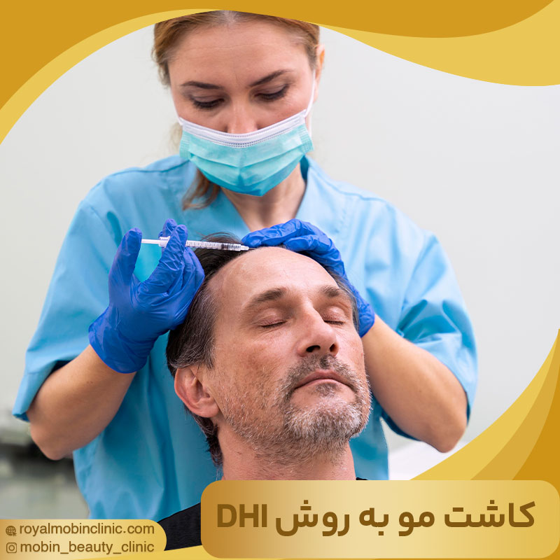 کاشت مو به روش DHI