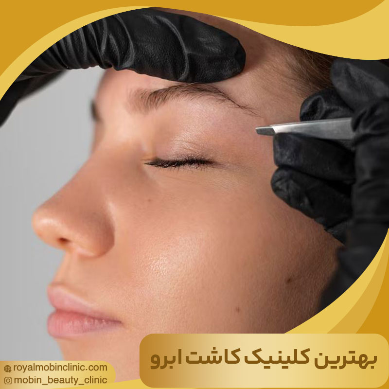 بهترین کلینیک کاشت ابرو