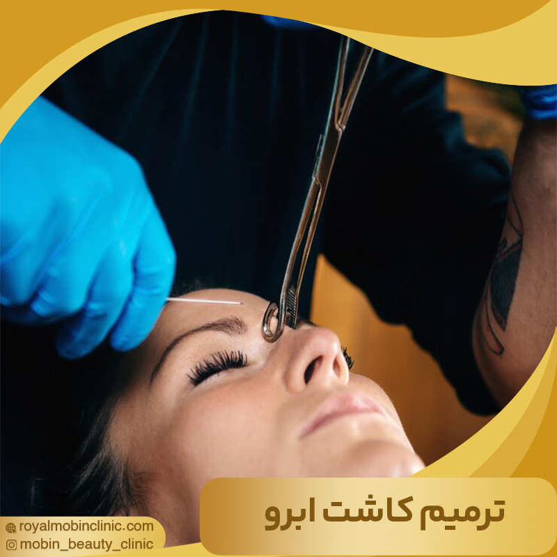 ترمیم کاشت ابرو