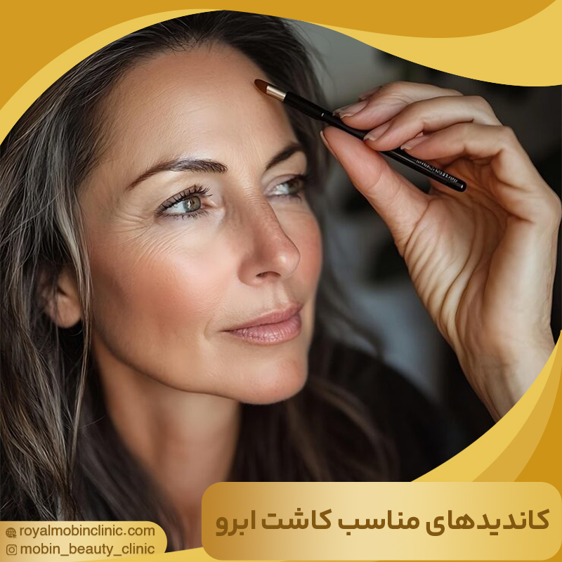کاندیدهای مناسب کاشت ابرو