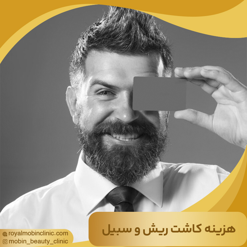 هزینه کاشت ریش و سبیل