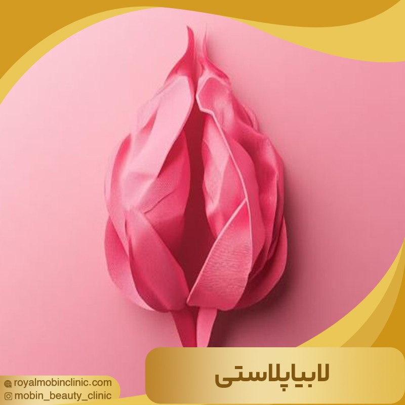 لابیاپلاستی چیست؟