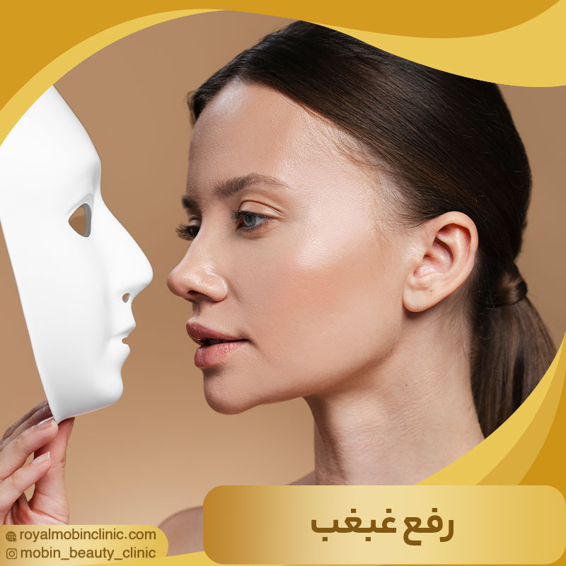 رفع غبغب