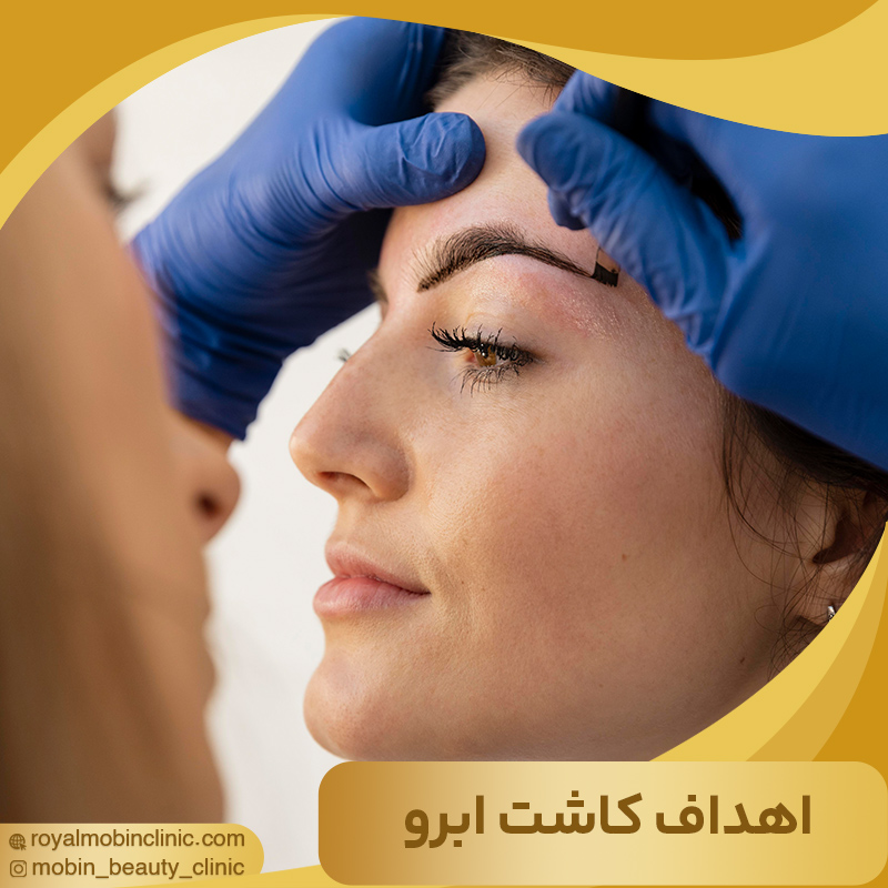 اهداف کاشت ابرو