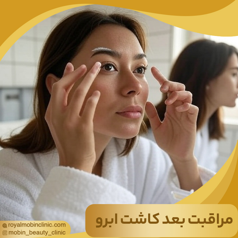 مراقبت های بعد از کاشت ابرو