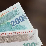 هزینه کاشت مو