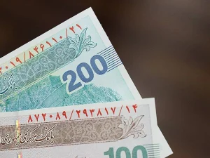 هزینه کاشت مو