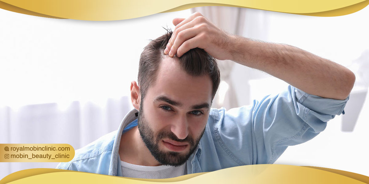 اقدامات قبل از کاشت مو
