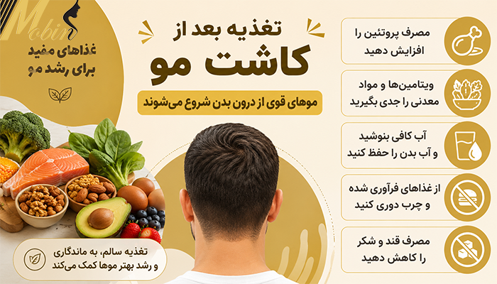 تغذیه بعد از کاشت مو