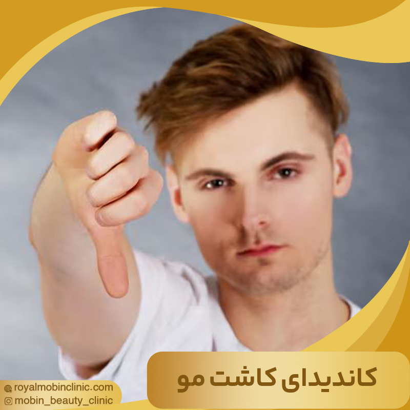 کاندیدای مناسب کاشت مو