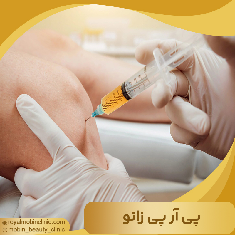 پی آر پی زانو
