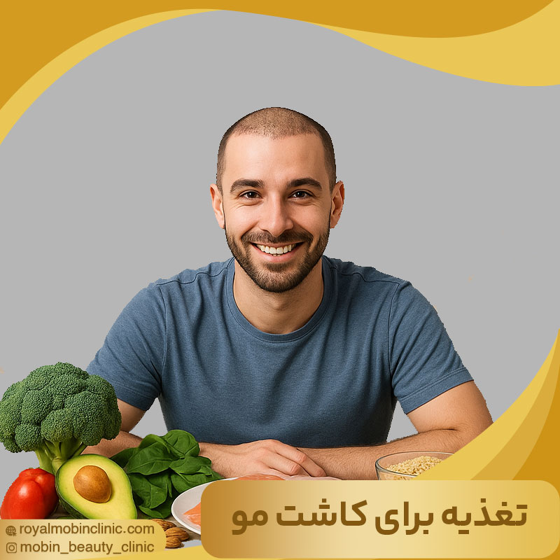 نقش تغذیه در کاشت مو