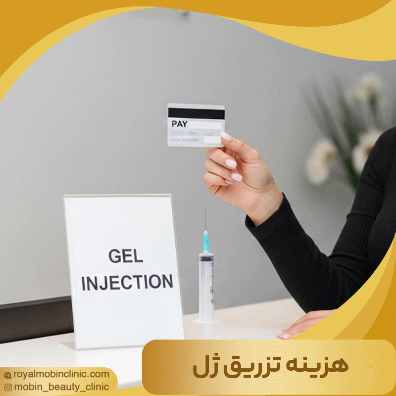 هزینه تزریق ژل