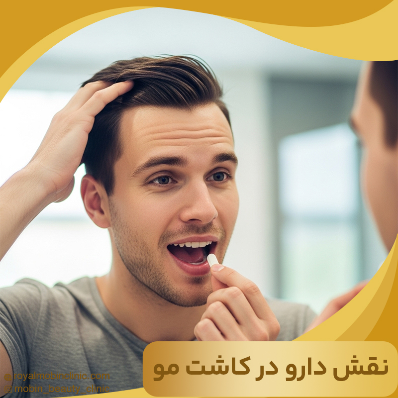نقش دارو در کاشت مو