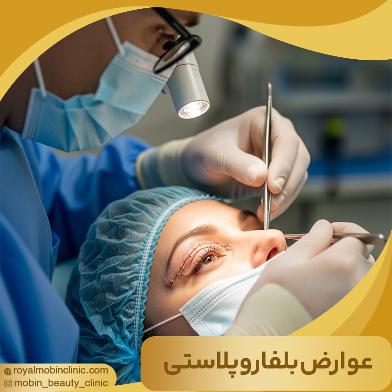 عوارض بلفاروپلاستی