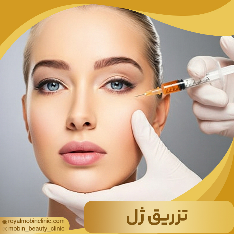 تزریق ژل