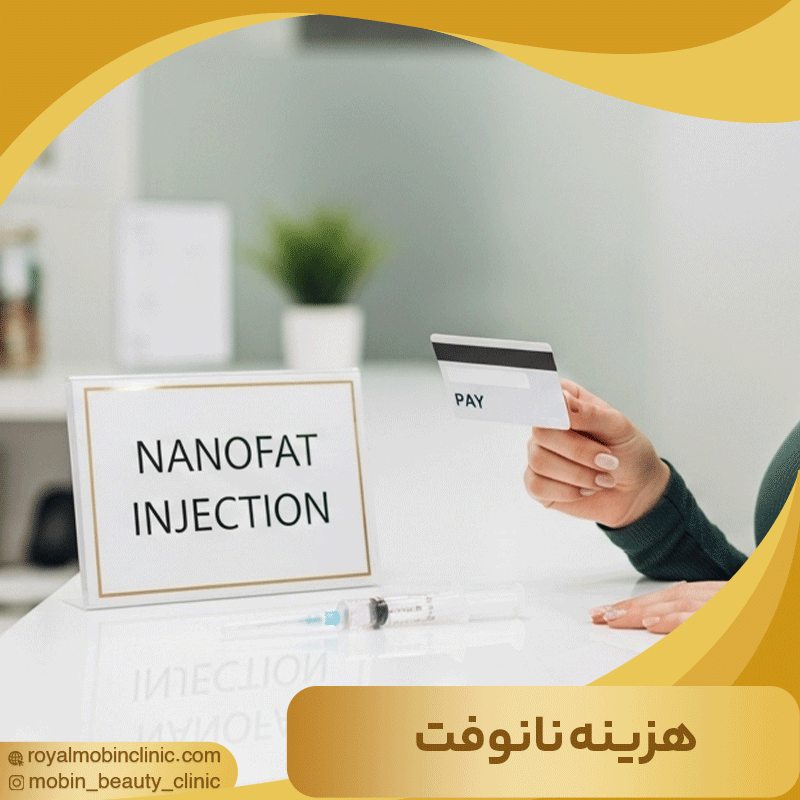 هزینه نانوفت