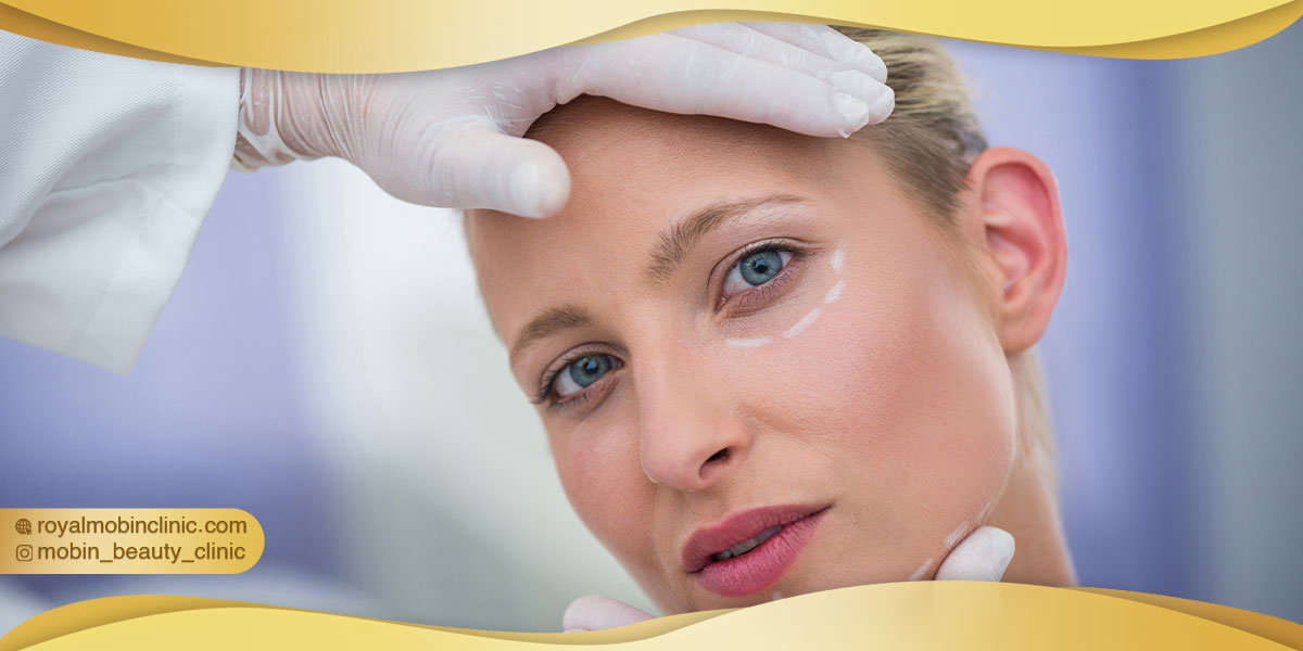 معایب لیفت شقیقه