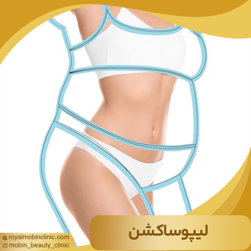 لیپوساکشن چیست؟