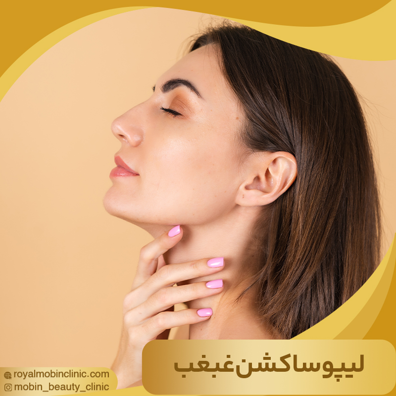 لیپوساکشن غبغب