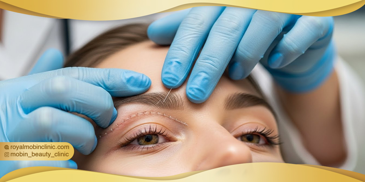 درمان تخصصی جای بخیه بلفاروپلاستی