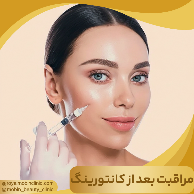 مراقبت های بعد از کانتورینگ با ژل