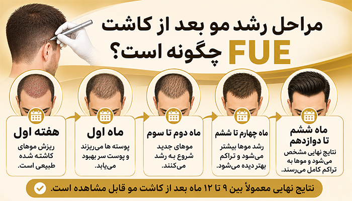 مراحل رشد مو بعد از کاشت FUE چگونه است؟