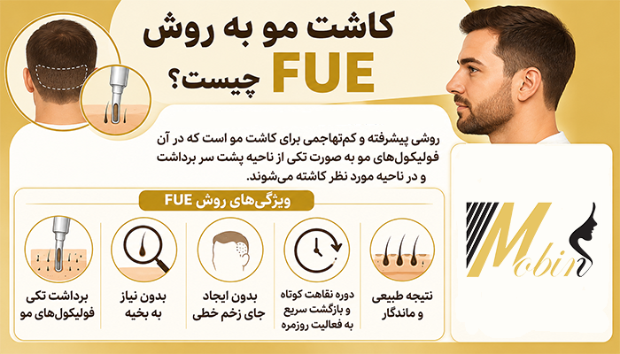 کاشت مو به روش FUE چیست؟