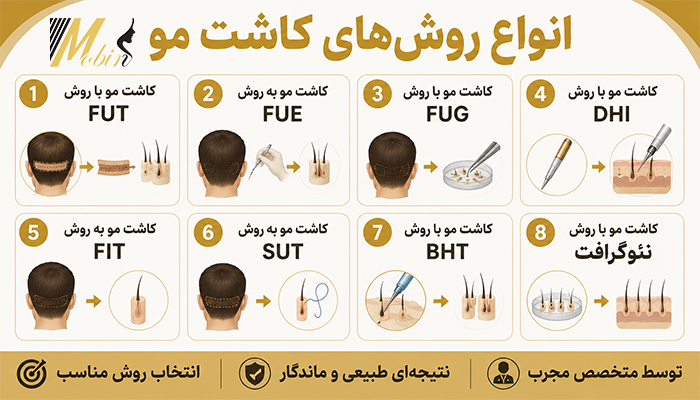 انواع روش های کاشت مو