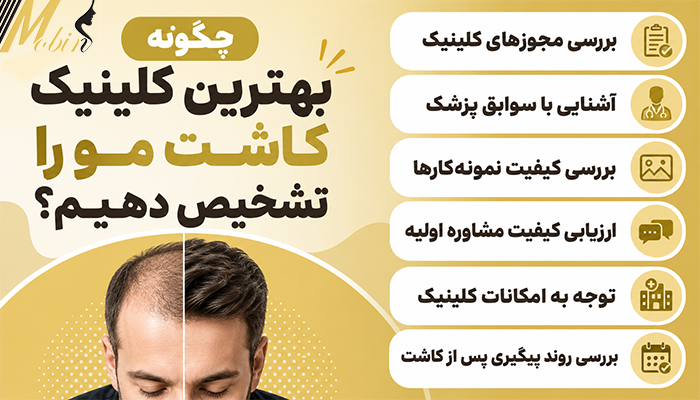 چگونه بهترین کلینیک کاشت مو را تشخیص دهیم؟