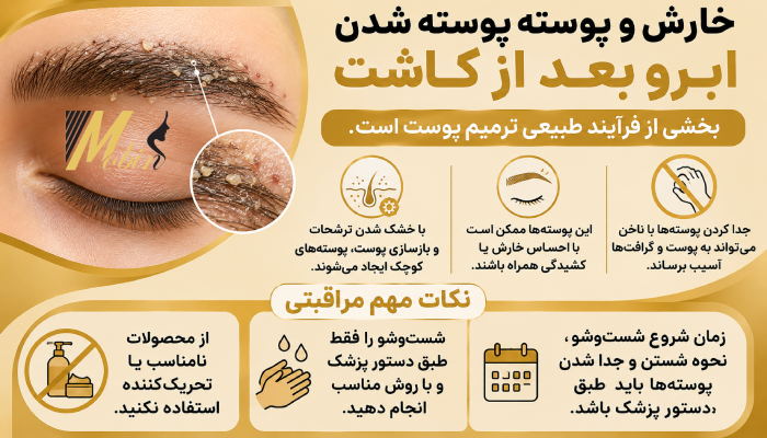 خارش و پوسته پوسته شدن ابرو بعد از کاشت