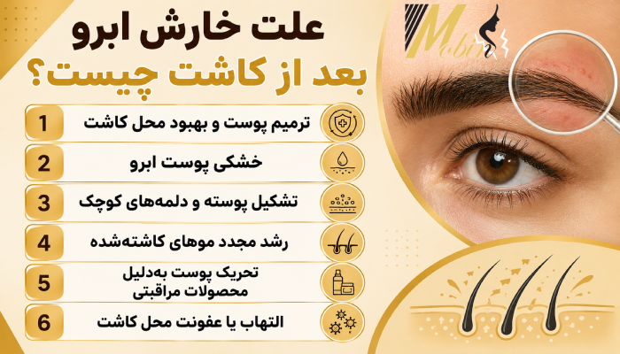 علت خارش ابرو بعد از کاشت